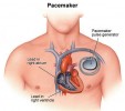 Pacemaker_biology